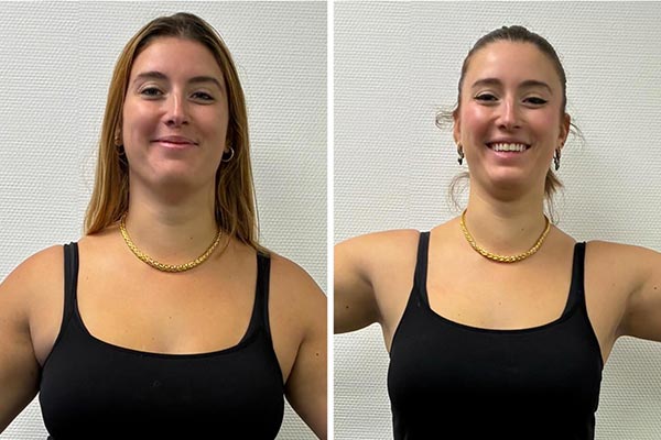 Exemple perte de poids